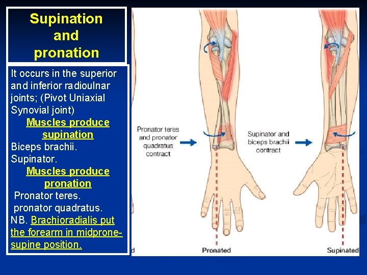 Supination and pronation It occurs in the superior and inferior radioulnar joints; (Pivot Uniaxial