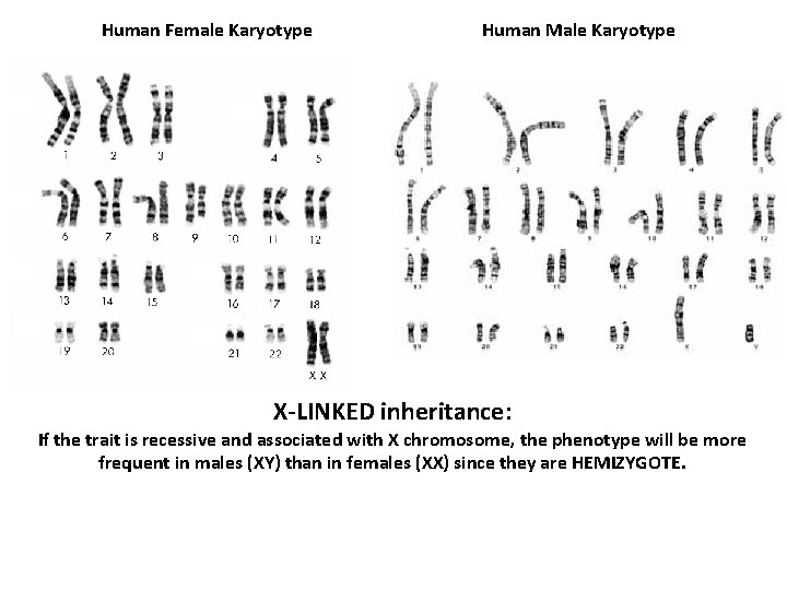 Human Female Karyotype Human Male Karyotype X-LINKED inheritance: If the trait is recessive and
