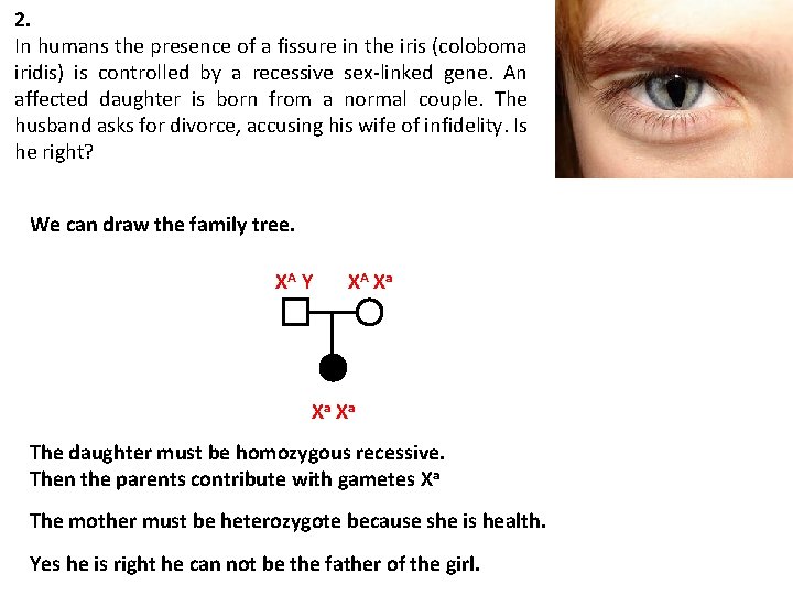 2. In humans the presence of a fissure in the iris (coloboma iridis) is