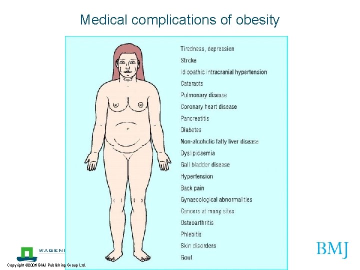 Medical complications of obesity Copyright © 2006 BMJ Publishing Group Ltd. 