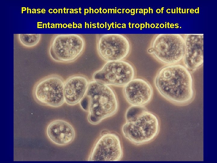 Phase contrast photomicrograph of cultured Entamoeba histolytica trophozoites. 