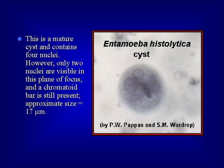 l This is a mature cyst and contains four nuclei. However, only two nuclei
