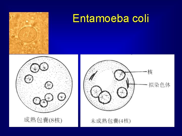 Entamoeba coli 