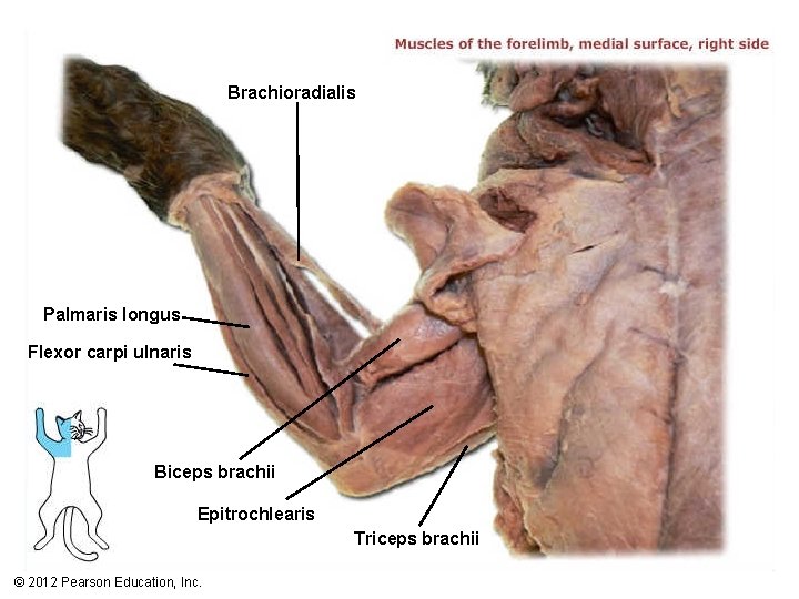 Brachioradialis Palmaris longus Flexor carpi ulnaris Biceps brachii Epitrochlearis Triceps brachii © 2012 Pearson