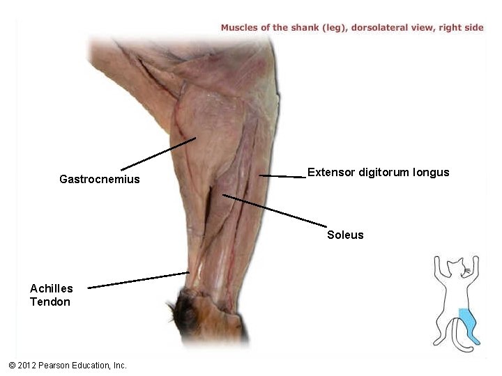 Gastrocnemius Extensor digitorum longus Soleus Achilles Tendon © 2012 Pearson Education, Inc. 