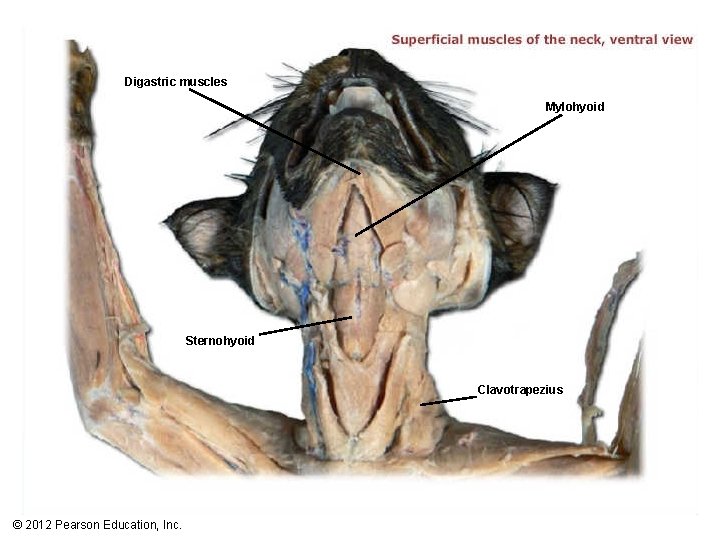 Digastric muscles Mylohyoid Sternohyoid Clavotrapezius © 2012 Pearson Education, Inc. 