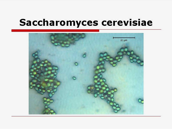 Saccharomyces cerevisiae 