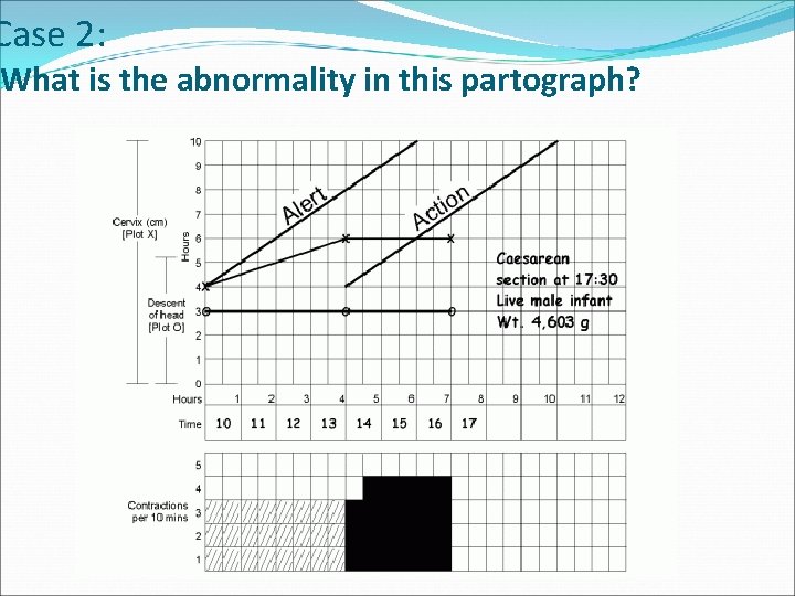 Case 2: What is the abnormality in this partograph? 