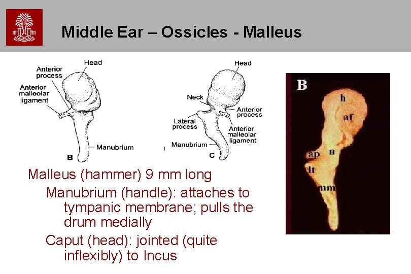 Middle Ear – Ossicles - Malleus (hammer) 9 mm long Manubrium (handle): attaches to