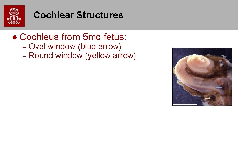 Cochlear Structures Cochleus from 5 mo fetus: – – Oval window (blue arrow) Round Cochlear Structures Cochleus from 5 mo fetus: – – Oval window (blue arrow) Round