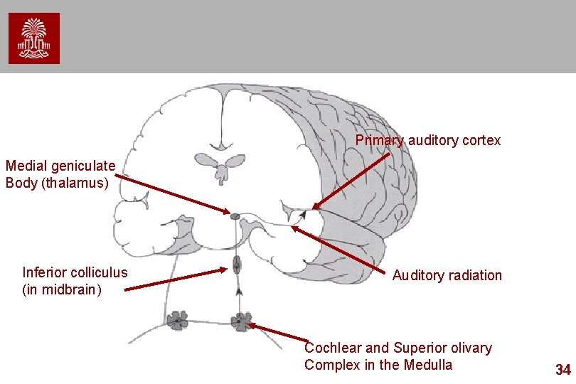 Primary auditory cortex Medial geniculate Body (thalamus) Inferior colliculus (in midbrain) Auditory radiation Cochlear