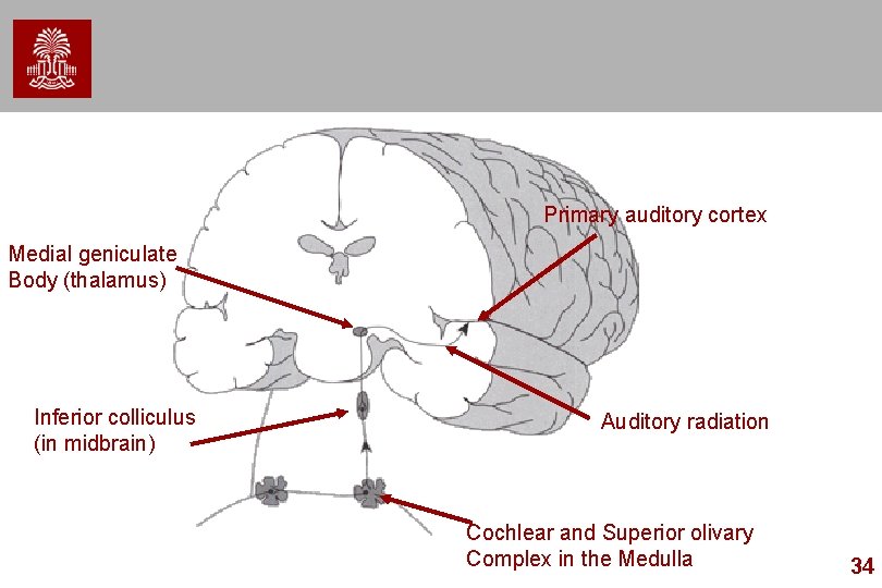 Primary auditory cortex Medial geniculate Body (thalamus) Inferior colliculus (in midbrain) Auditory radiation Cochlear Primary auditory cortex Medial geniculate Body (thalamus) Inferior colliculus (in midbrain) Auditory radiation Cochlear