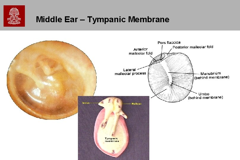 Middle Ear – Tympanic Membrane 