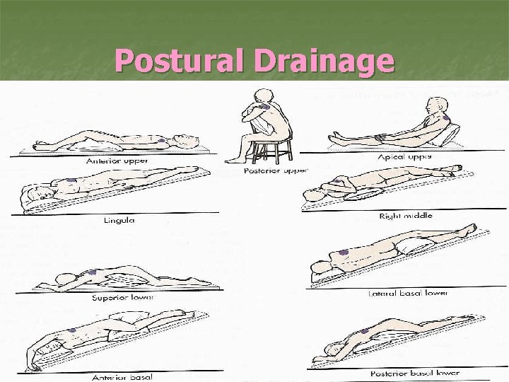 Postural Drainage 