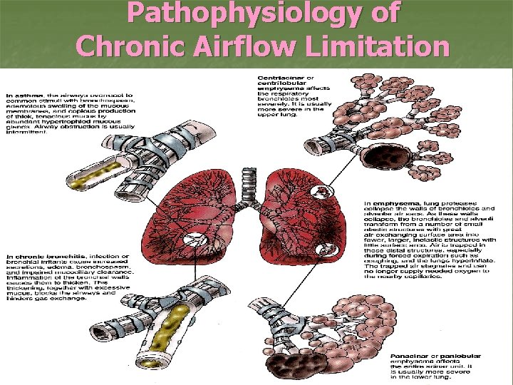 Pathophysiology of Chronic Airflow Limitation 