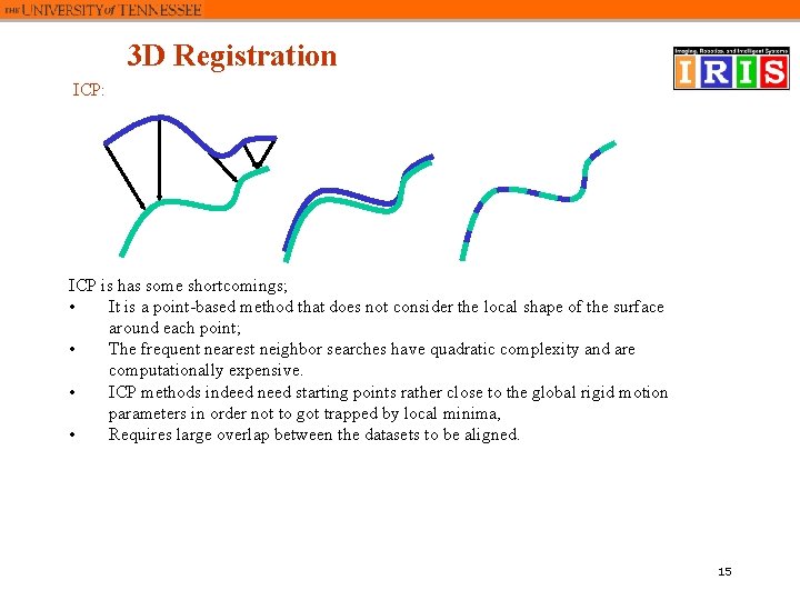 3 D Registration ICP: ICP is has some shortcomings; • It is a point-based