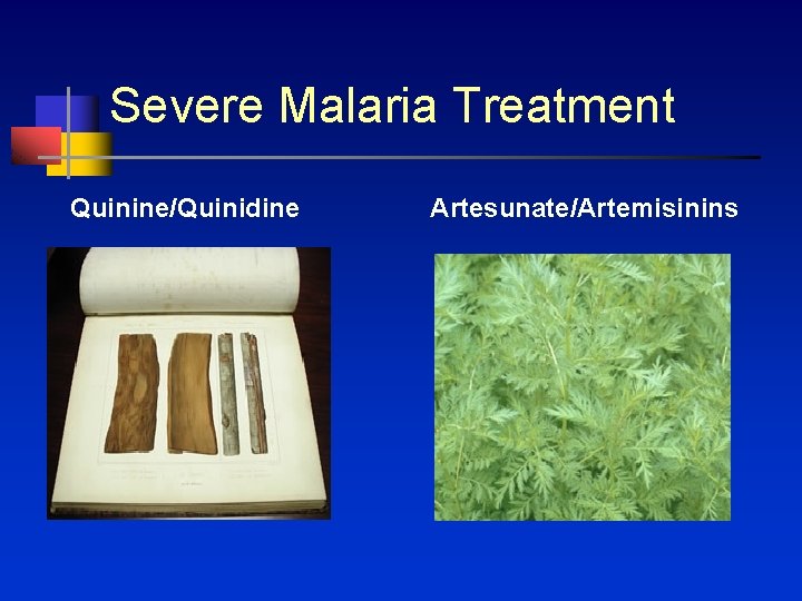 Severe Malaria Treatment Quinine/Quinidine Artesunate/Artemisinins 