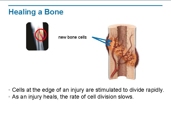 Healing a Bone new bone cells • Cells at the edge of an injury