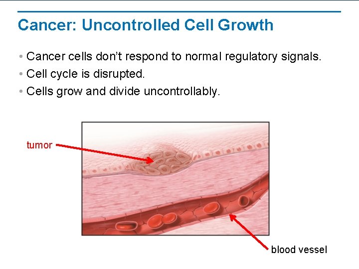 Cancer: Uncontrolled Cell Growth • Cancer cells don’t respond to normal regulatory signals. •