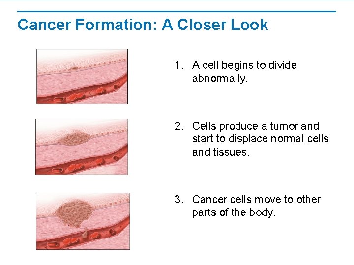 Cancer Formation: A Closer Look 1. A cell begins to divide abnormally. 2. Cells