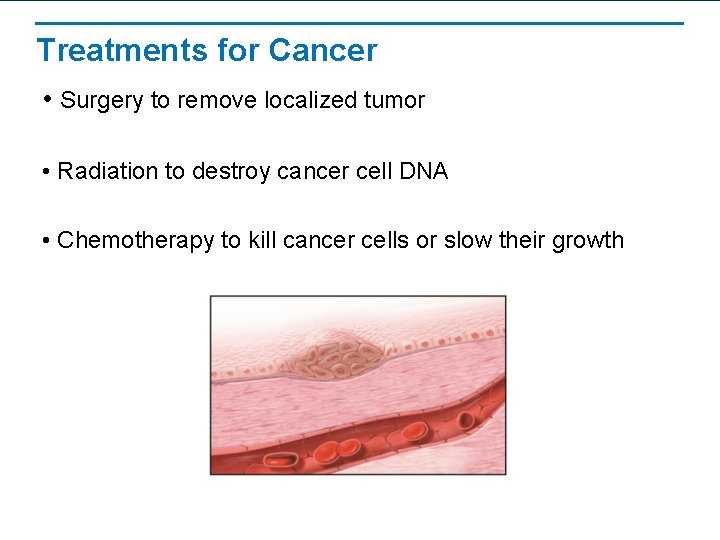 Treatments for Cancer • Surgery to remove localized tumor • Radiation to destroy cancer