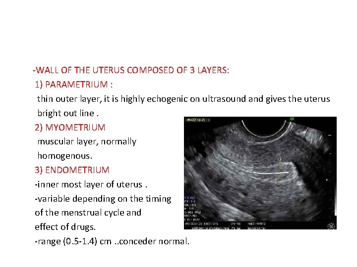 -WALL OF THE UTERUS COMPOSED OF 3 LAYERS: 1) PARAMETRIUM : thin outer layer,