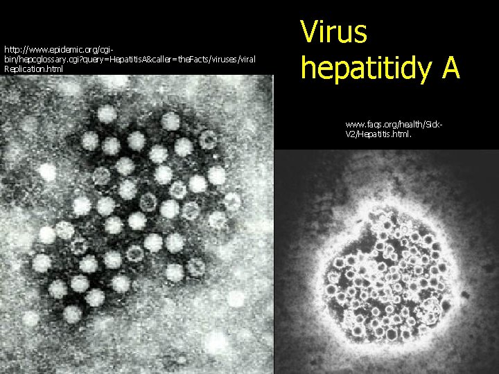 http: //www. epidemic. org/cgibin/hepcglossary. cgi? query=Hepatitis. A&caller=the. Facts/viruses/viral Replication. html Virus hepatitidy A www.