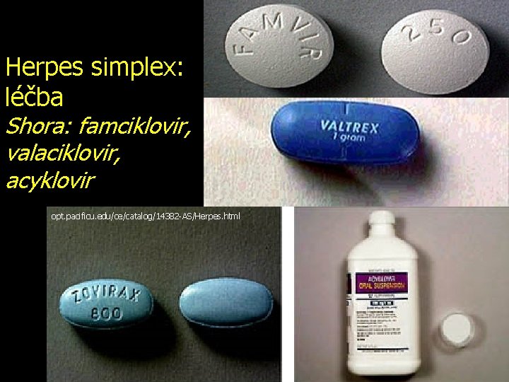 Herpes simplex: léčba Shora: famciklovir, valaciklovir, acyklovir opt. pacificu. edu/ce/catalog/14382 -AS/Herpes. html 