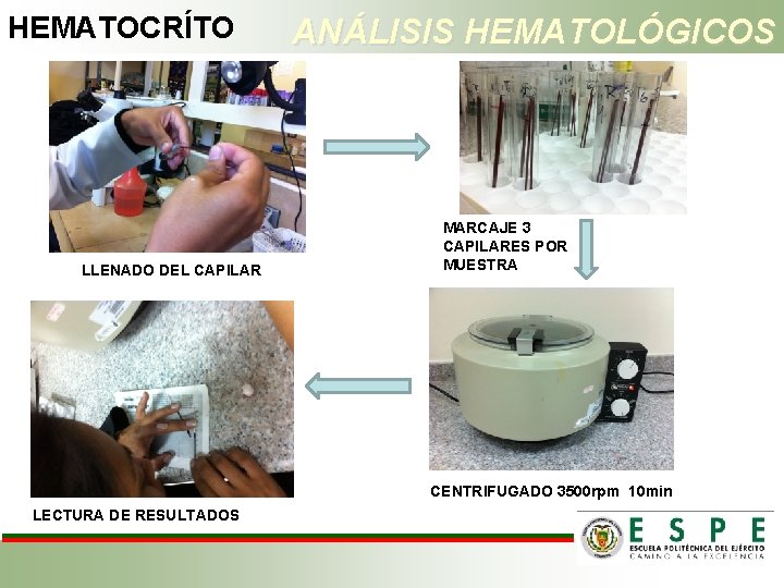 HEMATOCRÍTO LLENADO DEL CAPILAR ANÁLISIS HEMATOLÓGICOS MARCAJE 3 CAPILARES POR MUESTRA CENTRIFUGADO 3500 rpm