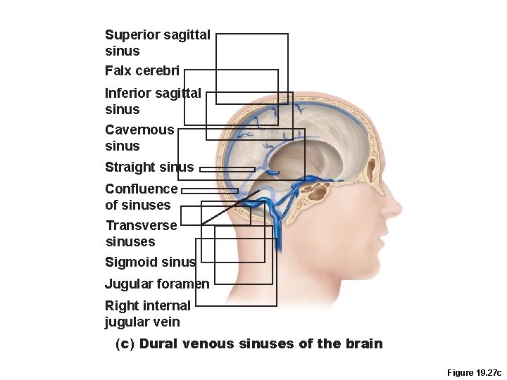 Superior sagittal sinus Falx cerebri Inferior sagittal sinus Cavernous sinus Straight sinus Confluence of Superior sagittal sinus Falx cerebri Inferior sagittal sinus Cavernous sinus Straight sinus Confluence of