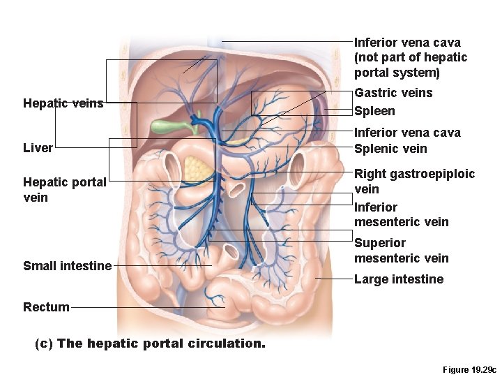 Inferior vena cava (not part of hepatic portal system) Hepatic veins Liver Hepatic portal Inferior vena cava (not part of hepatic portal system) Hepatic veins Liver Hepatic portal