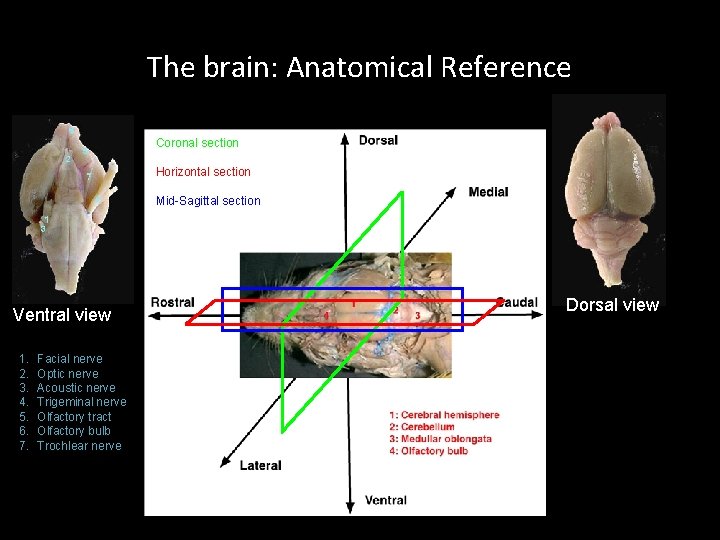 The brain: Anatomical Reference Coronal section Horizontal section Mid-Sagittal section Ventral view 1. 2.