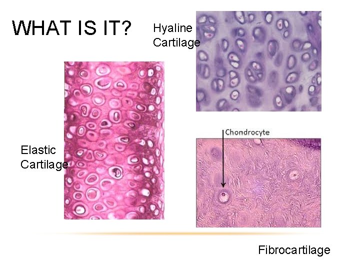 WHAT IS IT? Hyaline Cartilage Elastic Cartilage Fibrocartilage 
