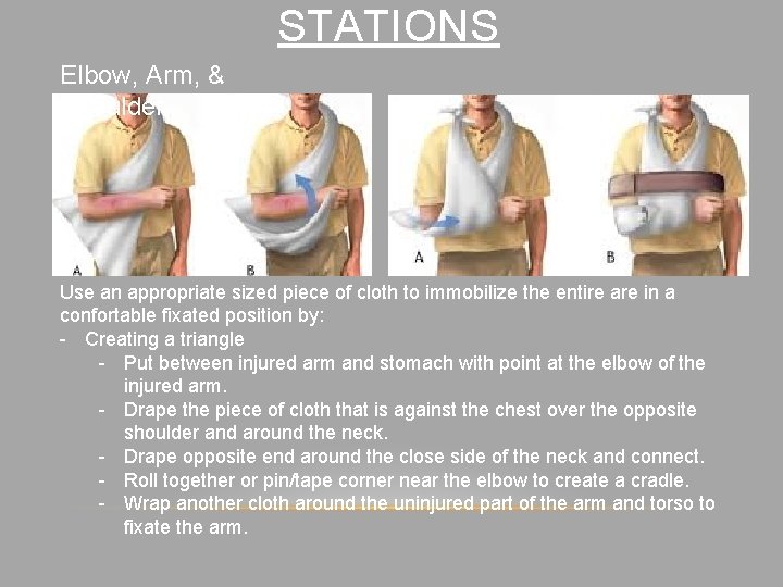 STATIONS Elbow, Arm, & Shoulder Use an appropriate sized piece of cloth to immobilize