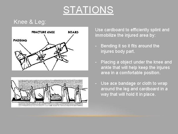 STATIONS Knee & Leg: Use cardboard to efficiently splint and immobilize the injured area