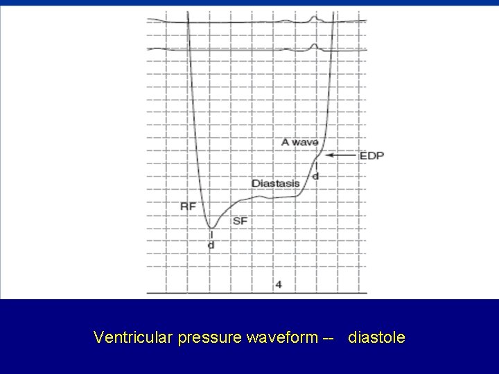 Ventricular pressure waveform -- diastole 