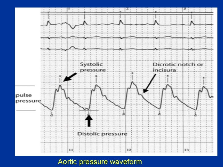 Aortic pressure waveform 