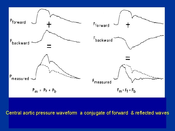 Central aortic pressure waveform a conjugate of forward & reflected waves 