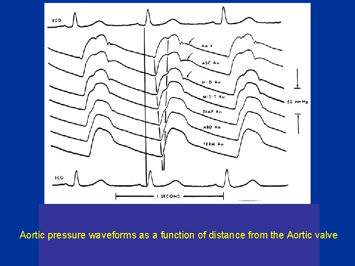 Aortic pressure waveforms as a function of distance from the Aortic valve 
