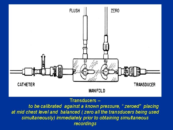 Transducers – to be calibrated against a known pressure, “ zeroed” placing at mid