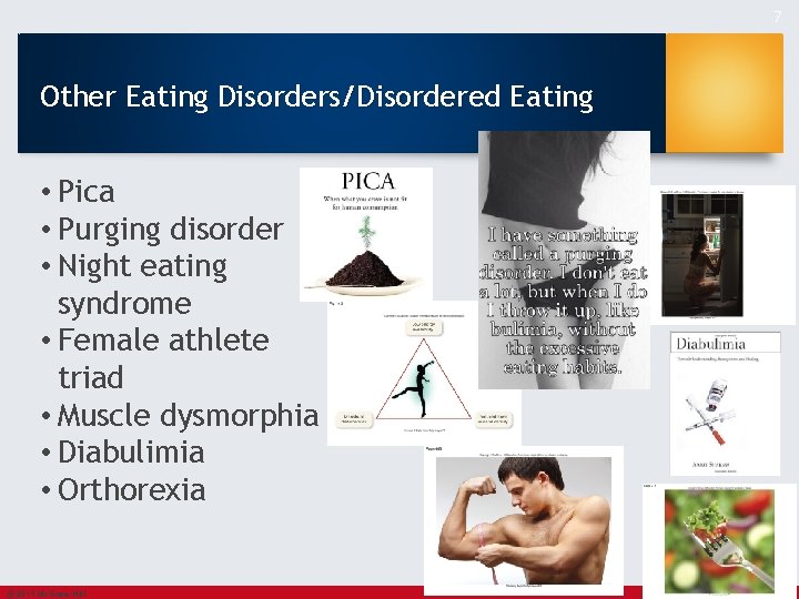7 Other Eating Disorders/Disordered Eating • Pica • Purging disorder • Night eating syndrome