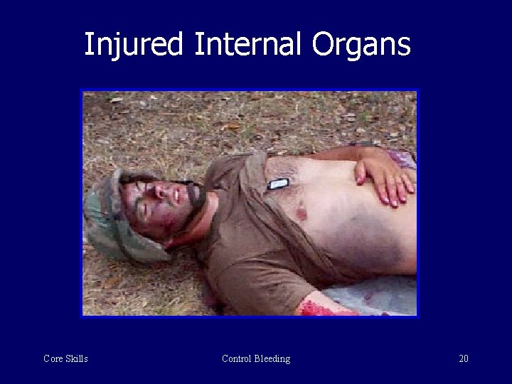 Injured Internal Organs Core Skills Control Bleeding 20 