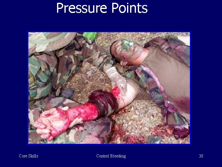 Pressure Points Core Skills Control Bleeding 30 