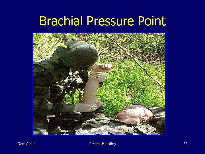 Brachial Pressure Point Core Skills Control Bleeding 33 