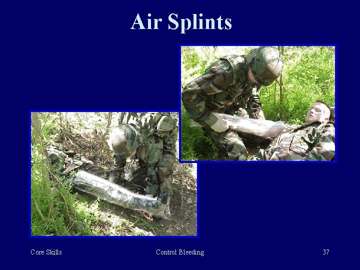Air Splints Core Skills Control Bleeding 37 