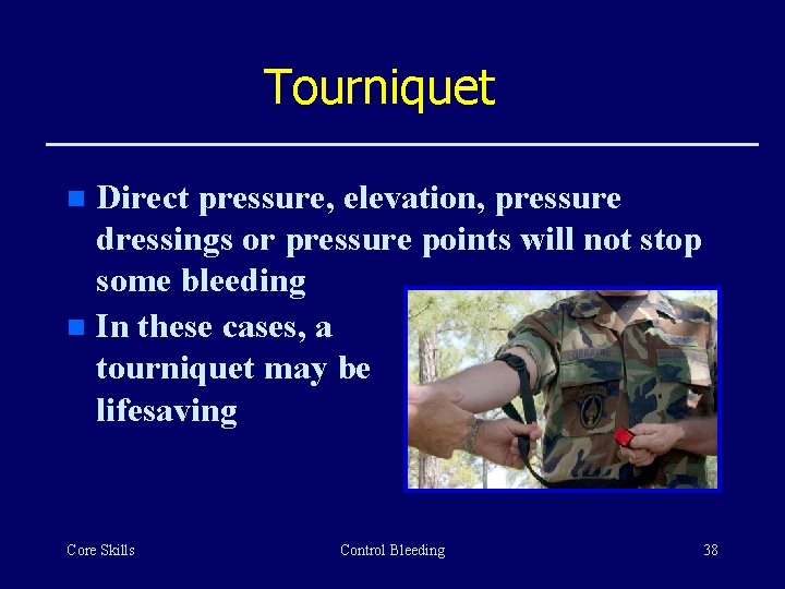 Tourniquet Direct pressure, elevation, pressure dressings or pressure points will not stop some bleeding
