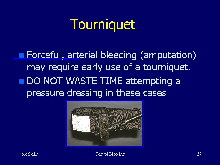Tourniquet Forceful, arterial bleeding (amputation) may require early use of a tourniquet. n DO