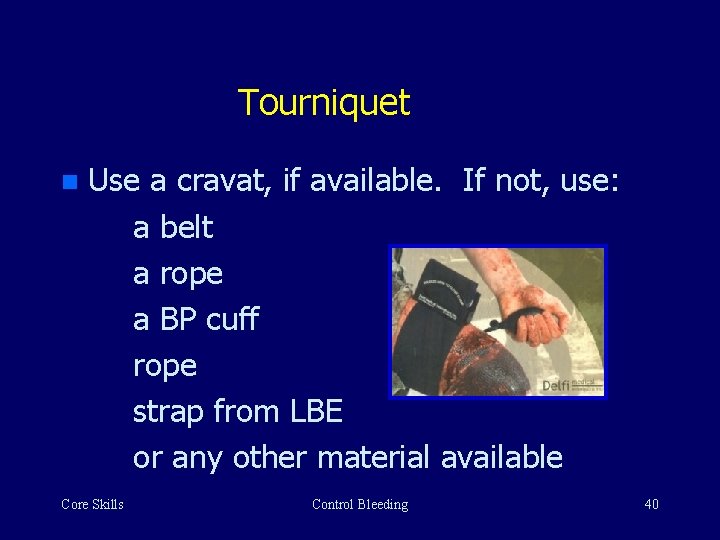 Tourniquet n Use a cravat, if available. If not, use: a belt a rope