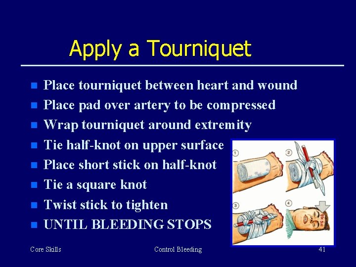 Apply a Tourniquet n n n n Place tourniquet between heart and wound Place