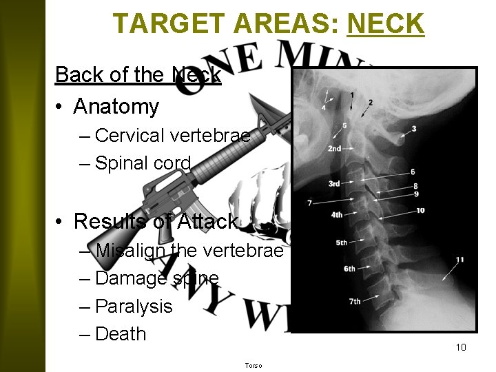 TARGET AREAS: NECK Back of the Neck • Anatomy – Cervical vertebrae – Spinal